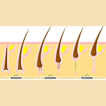 Pelos Voltam a Crescer Depois do Laser